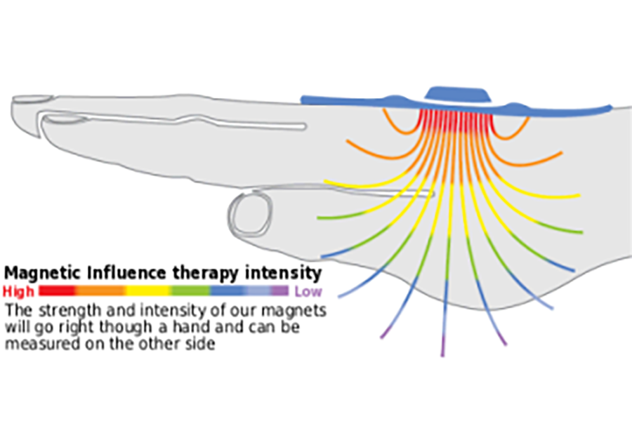 magnetic-influence-therapy-intensity